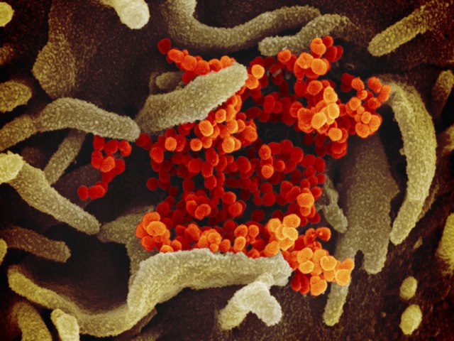 Novo vrus detectado na China j causou 35 infeces em humanos 