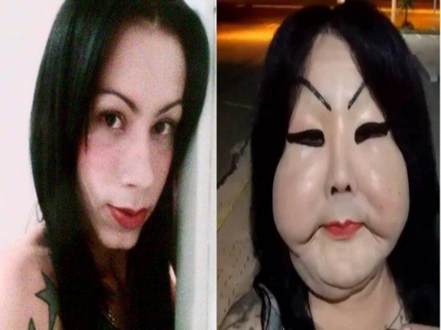 Voc conhece esta mulher? Pois ...Chamada de Fofo, a trans arrecada apenas R$ 8 mil em vaquinha, e no consegue a cirurgia para retirar o silicone do rosto.