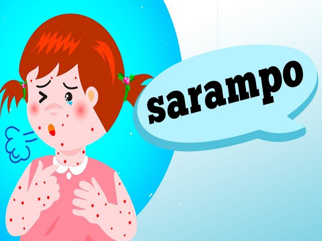Saiba quais os sintomas do sarampo