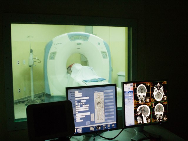 UPA Central de Votorantim realiza em mdia 130 exames de tomografia por ms