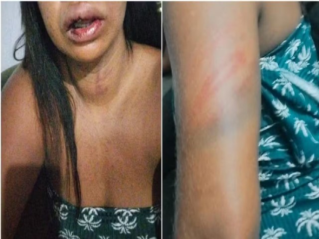 Mulher  agredida aps se atrasar 12 minutos para buscar o companheiro no trabalho