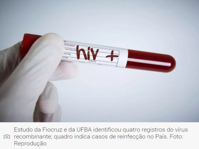 Nova variante do HIV  detectada na Bahia, Rio de Janeiro e Rio Grande do Sul