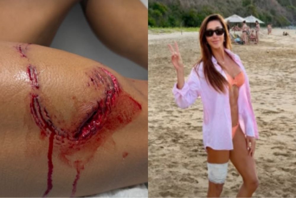 Turista � mordida por tubar�o durante mergulho em Fernando de Noronha.