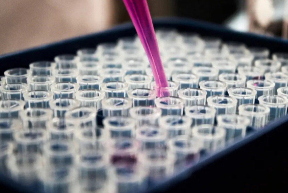 Um simples exame de sangue pode revelar doen�as silenciosas.