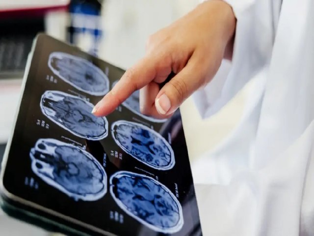 UM QUARTO DOS BRASILEIROS N�O SABE QUE O C�NCER PODE SER PREVENIDO; CONSCI�NCIA SOBRE ALGUNS FATORES DE RISO � BAIXA