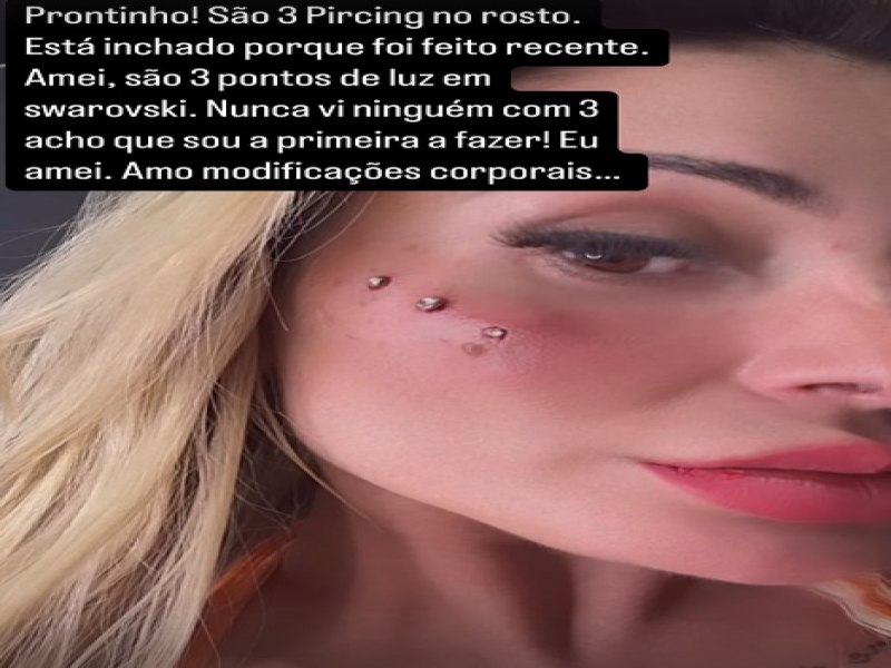 Andressa Urach desembolsa R$ 40 mil e faz nova modificao no rosto; veja