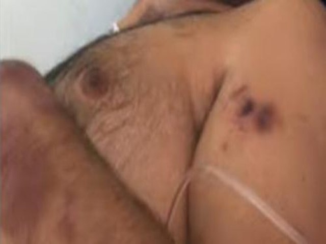 Dentista preso em Picos é encontrado com sinais espancamento em delegacia, denuncia família