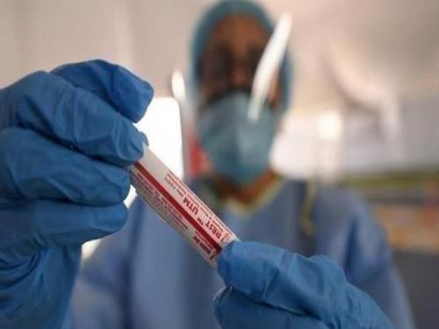 Taxa de incidência de coronavírus em Picos é de 1.6%