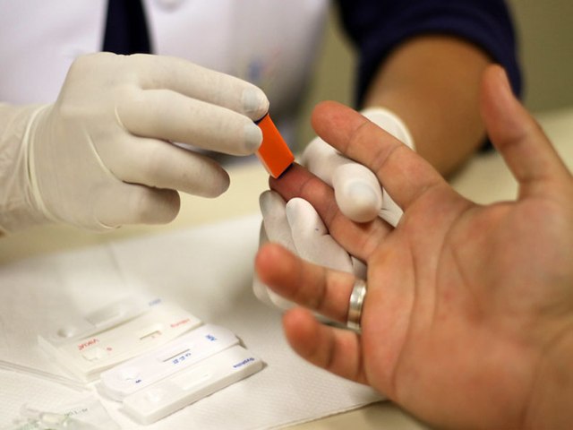 Ministério da Saúde monta sala de situação para descobrir causa de hepatite misteriosa