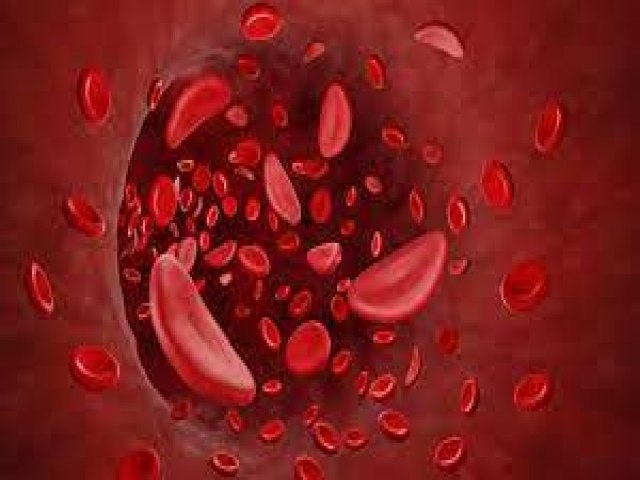 Saiba sobre transmissão e tratamentos da anemia falciforme