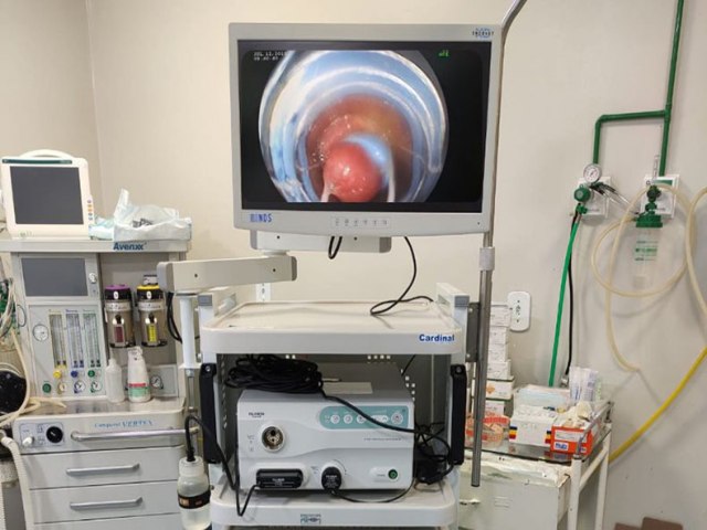 Hospital de Picos realiza 1º procedimento endoscópico em pacientes