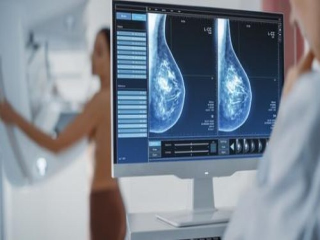 Caminhões da Mamografia percorrerão 20 municípios até dia 31