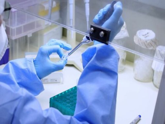 Testes tipo PCR para varíola dos macacos podem ter início na próxima semana