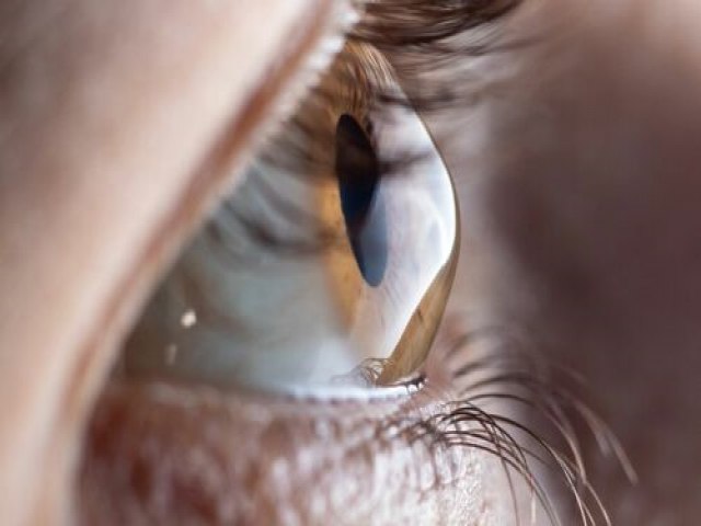 Dia Mundial do Ceratocone: doença ocular é responsável por maior parte dos transplantes de córnea no país