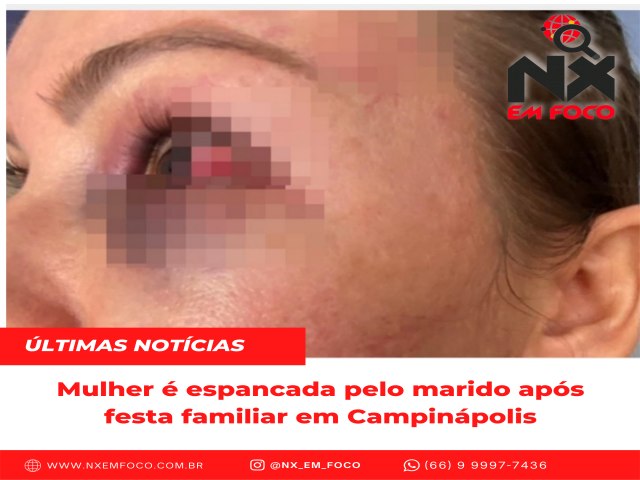 Mulher é espancada pelo marido após festa familiar em Campinápolis