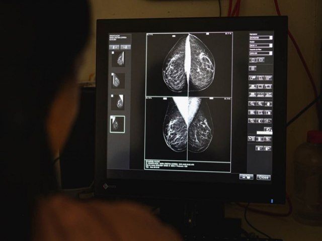 Prefeitura de Gravat passa a oferecer exame de mamografia regularmente