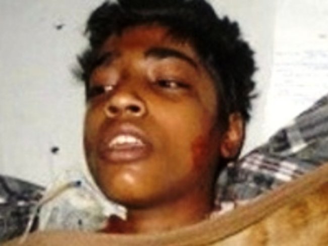 Adolescente paquistanês foi queimado vivo por divulgar sua fé
